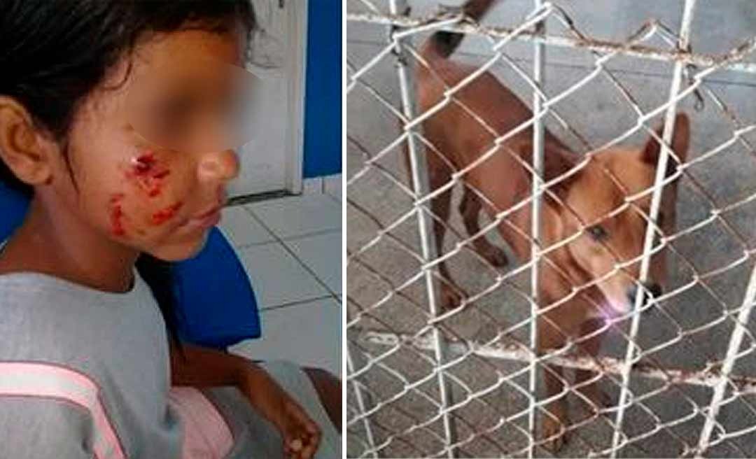 Cachorro abandonado ataca criança de 8 anos em Cruzeiro do Sul
